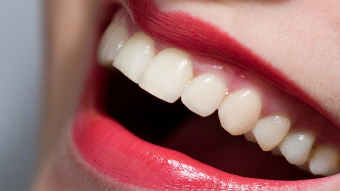 Νέο χαμόγελο με σύγχρονη οδοντιατρική